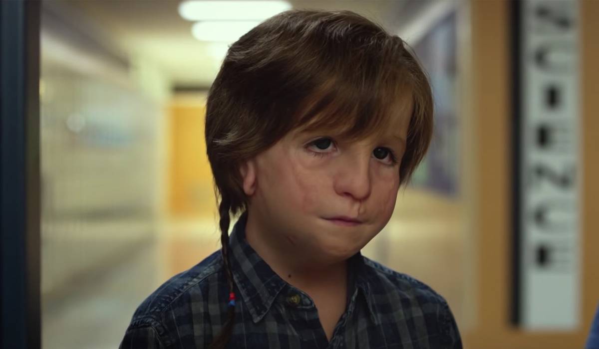 Wonder: Jacob Tremblay On His Prosthetic