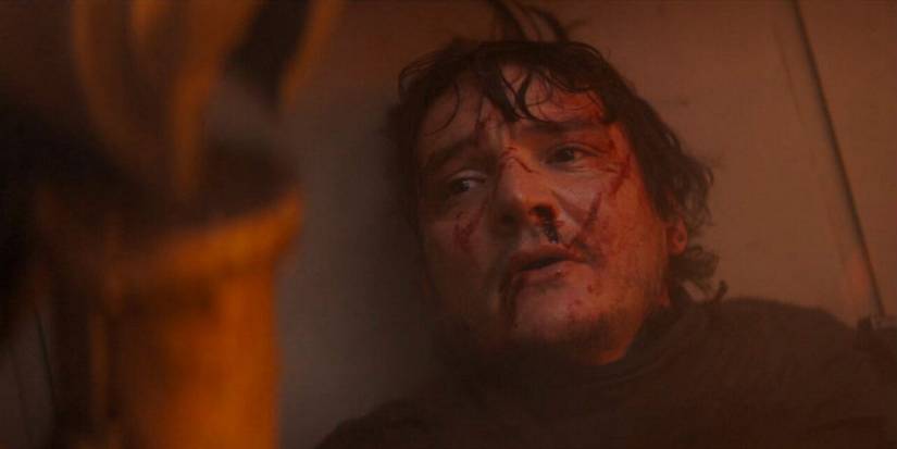 Pedro Pascal as Din Djarin in The Mandalorian very injuries across his face