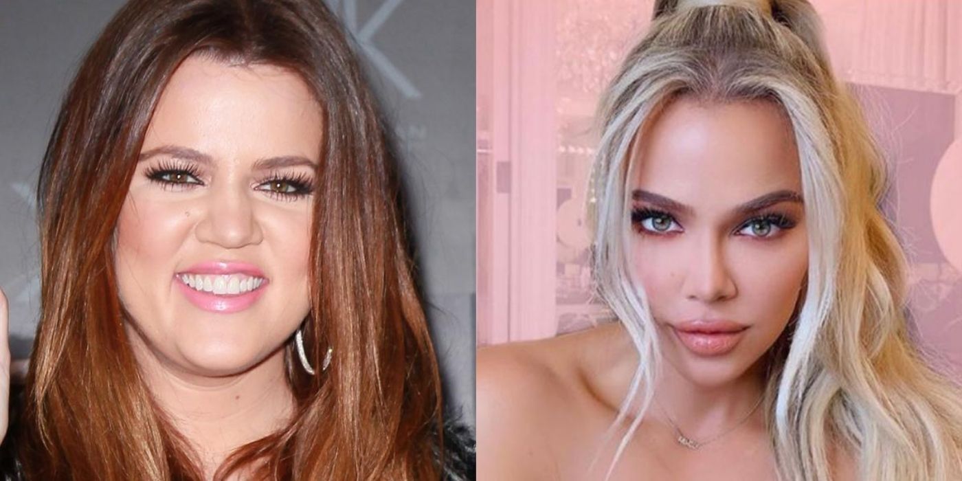 Kuwtk What Khloe Kardashian Looks Like Before After The Operation