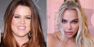 How The Kardashians Faces Have Changed How The Kardashians Faces Have Changed