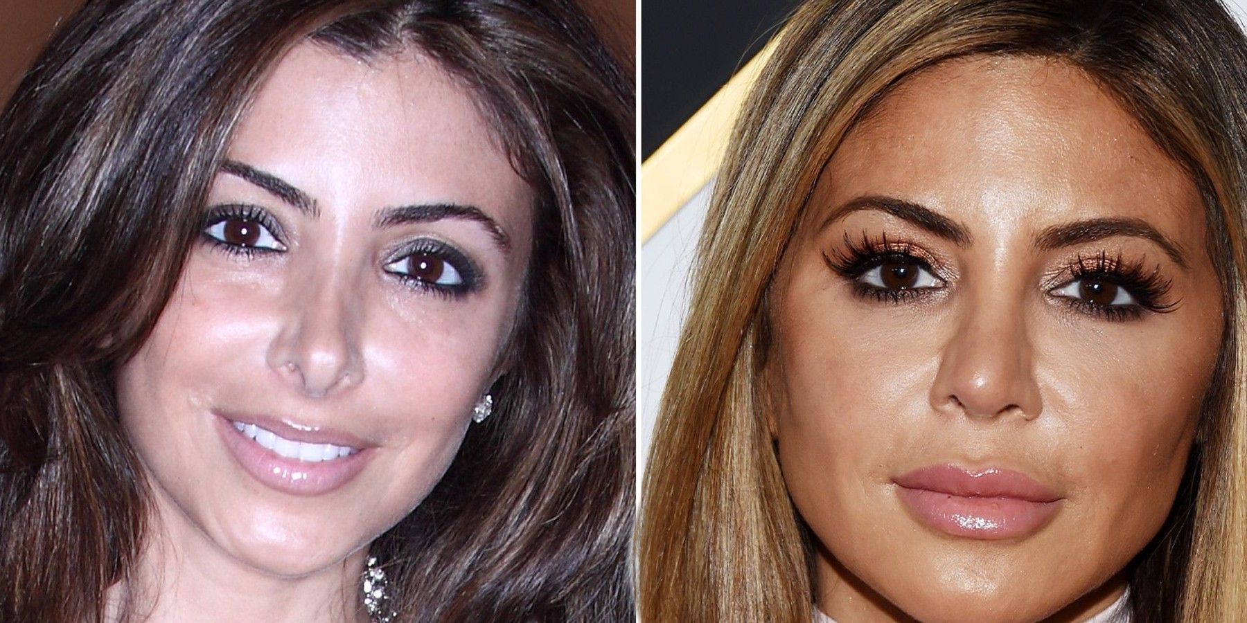 Real Housewives Of Miami All The Plastic Surgery The Cast Had Done
