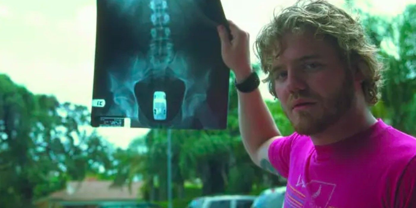 Ryan Dunn holds up an X-ray in Jackass The Movie