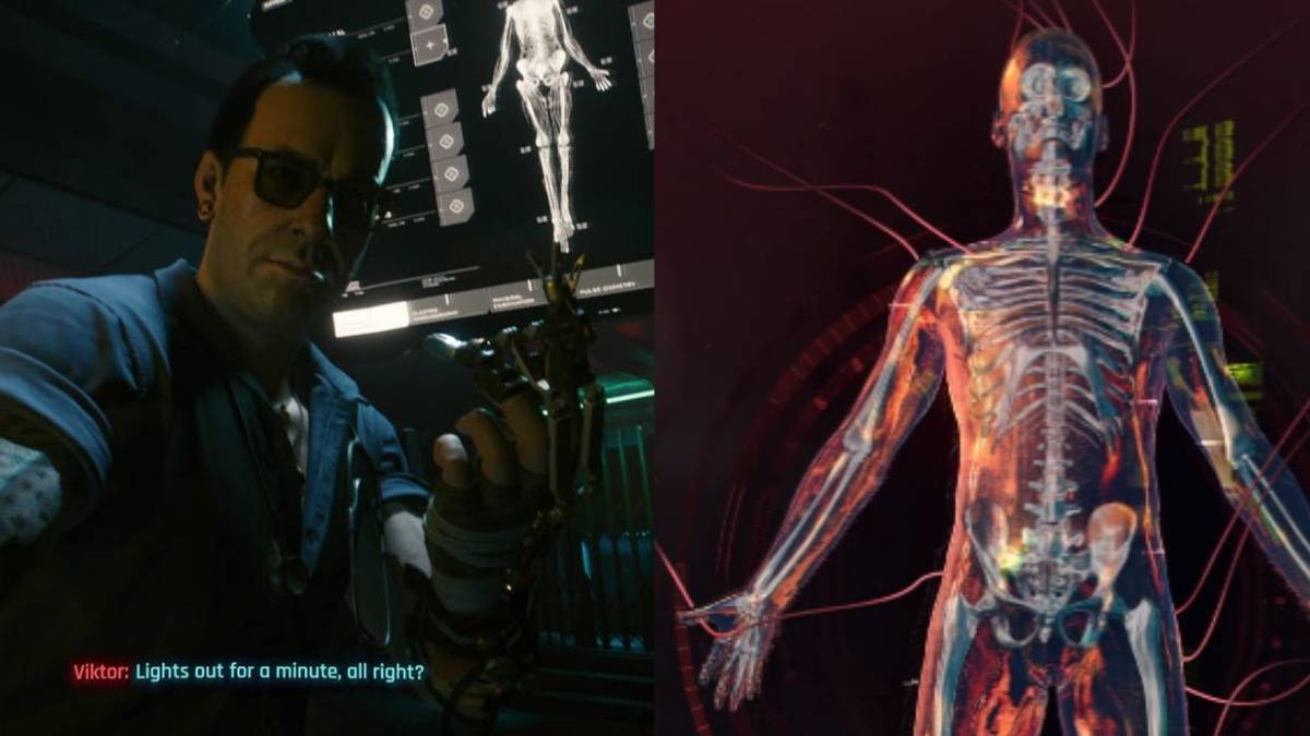 Cyberpunk 2077: 10 Best Upgrades, Ranked