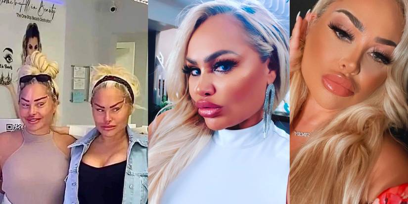 The Most Shocking 90 Day Fiancé Plastic Surgery Makeovers Of 2022