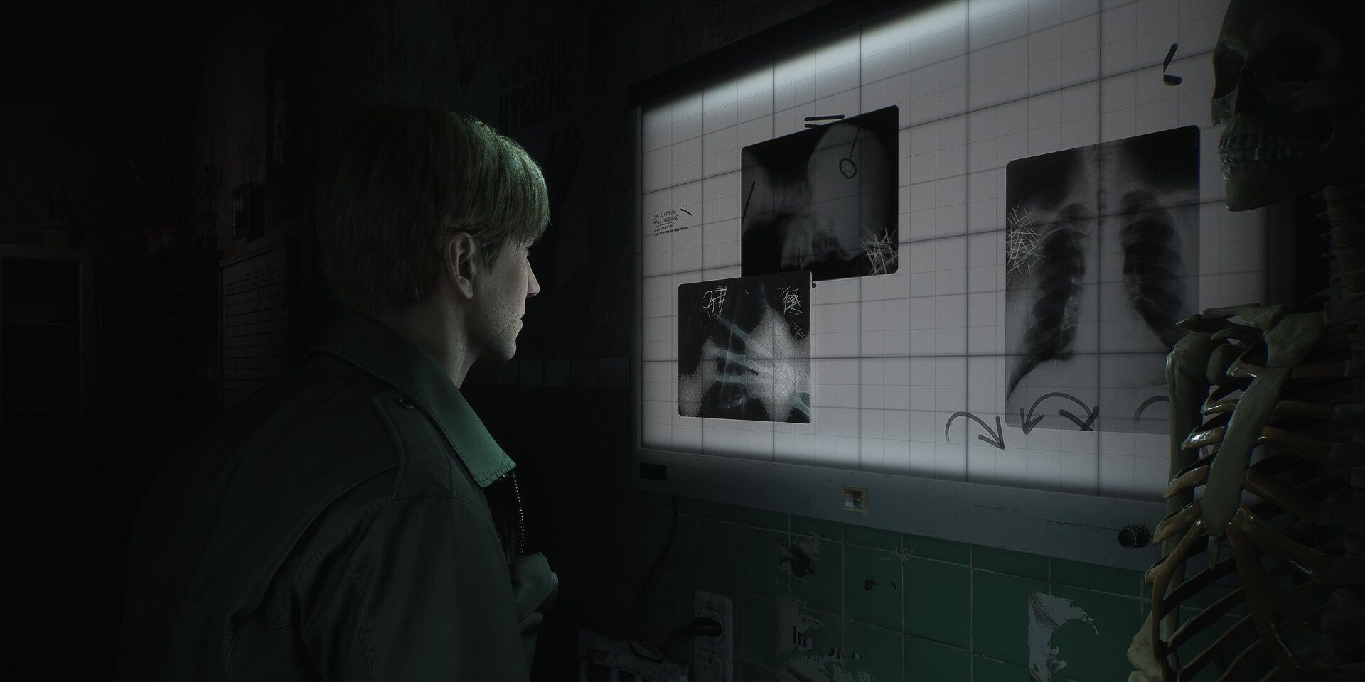 Silent Hill 2 Remake tiene una lección importante para enseñar a los fanáticos de los videojuegos