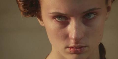 Sansa Stark (Sophie Turner) is looking angry with a bloody lip in Game of Thrones.