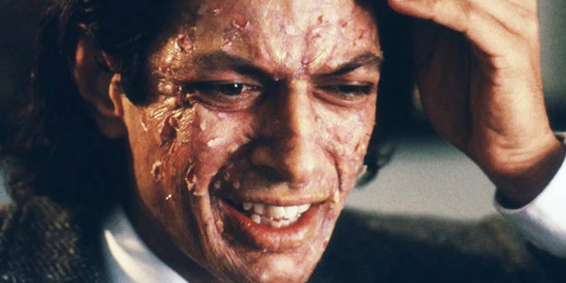 Jeff Goldblum's character Seth Brundle worries as his skin peels off in David Cronenberg's 1986 version of The Fly