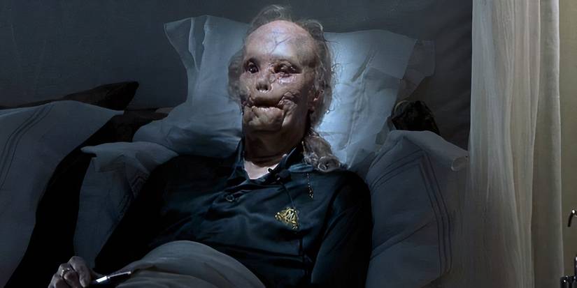 Gary Oldman como Mason Verger no filme Hannibal (2001).