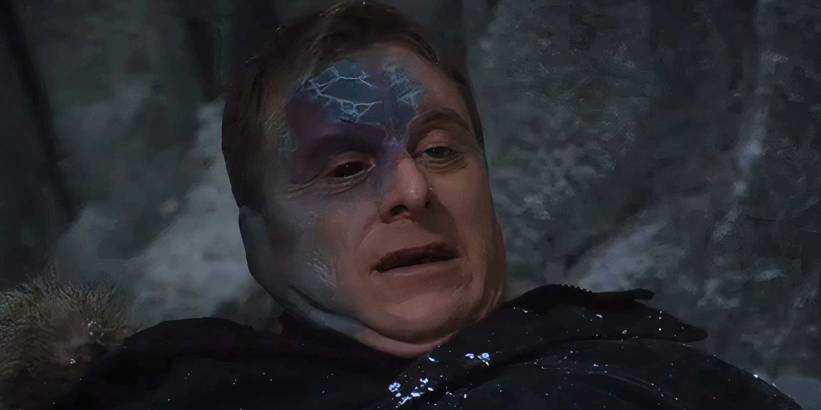 Alan Tudyk looking pained as Harry Vanderspeigle in Resident Alien