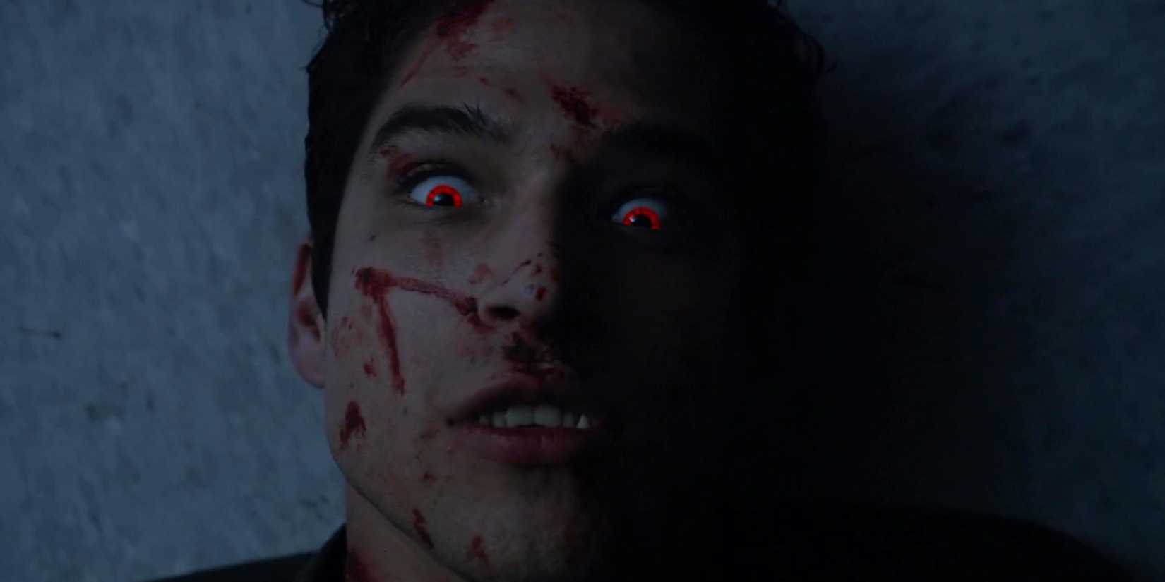 Scott McCall (Tyler Posey) Wakes Up In Teen Wolf Season 5, Episode 10, "Status Asthmaticus"
