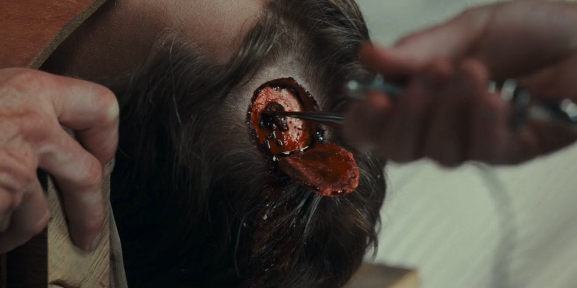 The doctor drills a hole into Zane Davis' head in 1923 season 2, episode 4