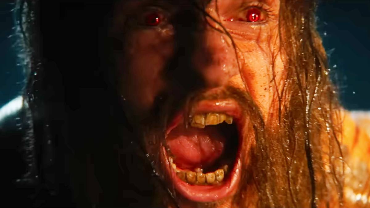 28 Years Later Sequel Update Confirms Whether Zombie Alpha Will Return