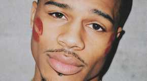Ace Greene from Love Island USA Season 7 with kiss marks on his face.