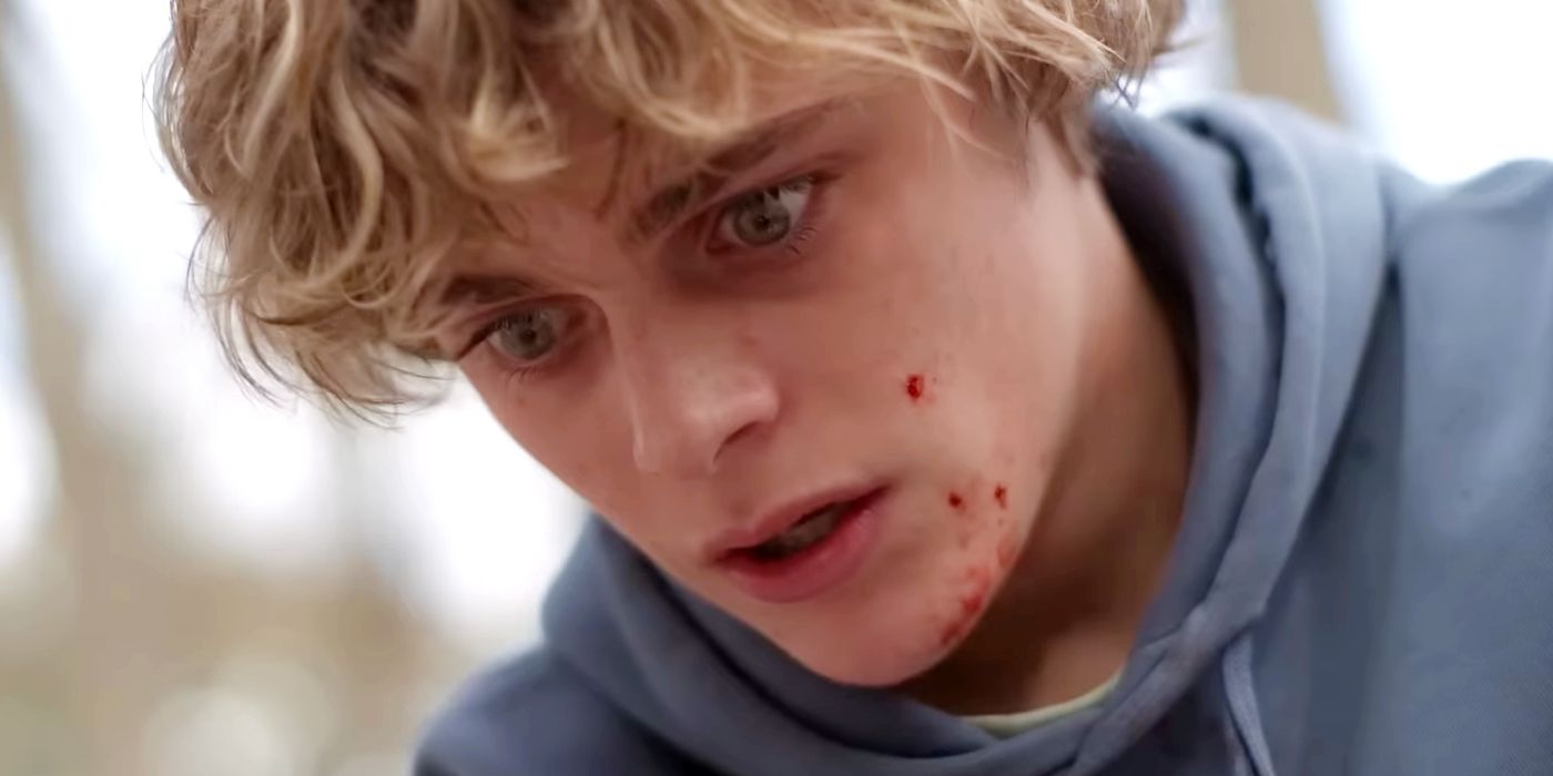 Billy Barrett looking shocked with blood on his face in Bring Her Back