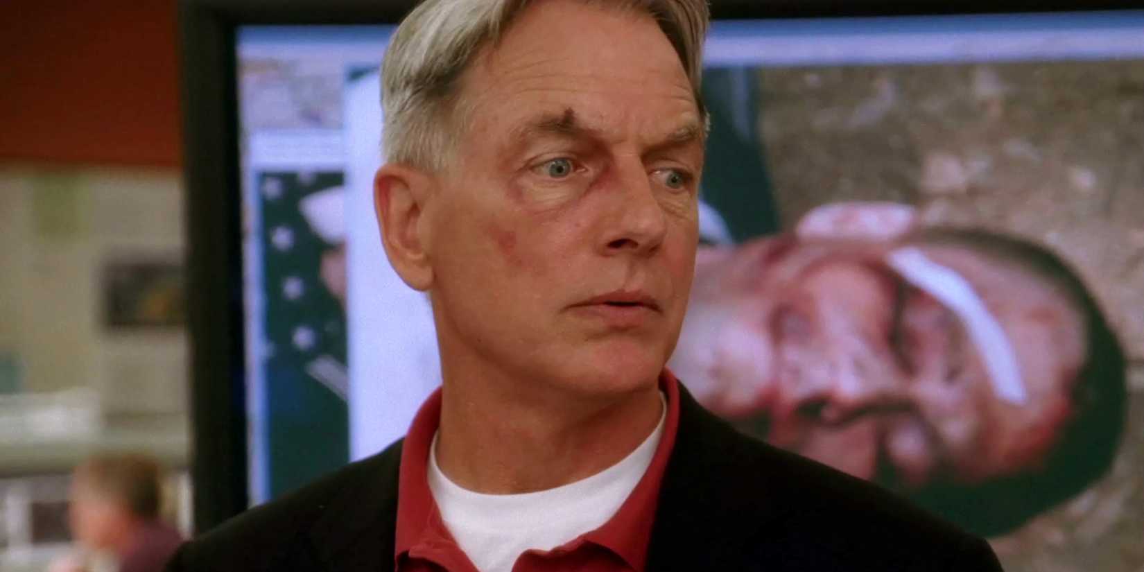 Gibbs with bruises on his face in the NCIS episode Road Kill