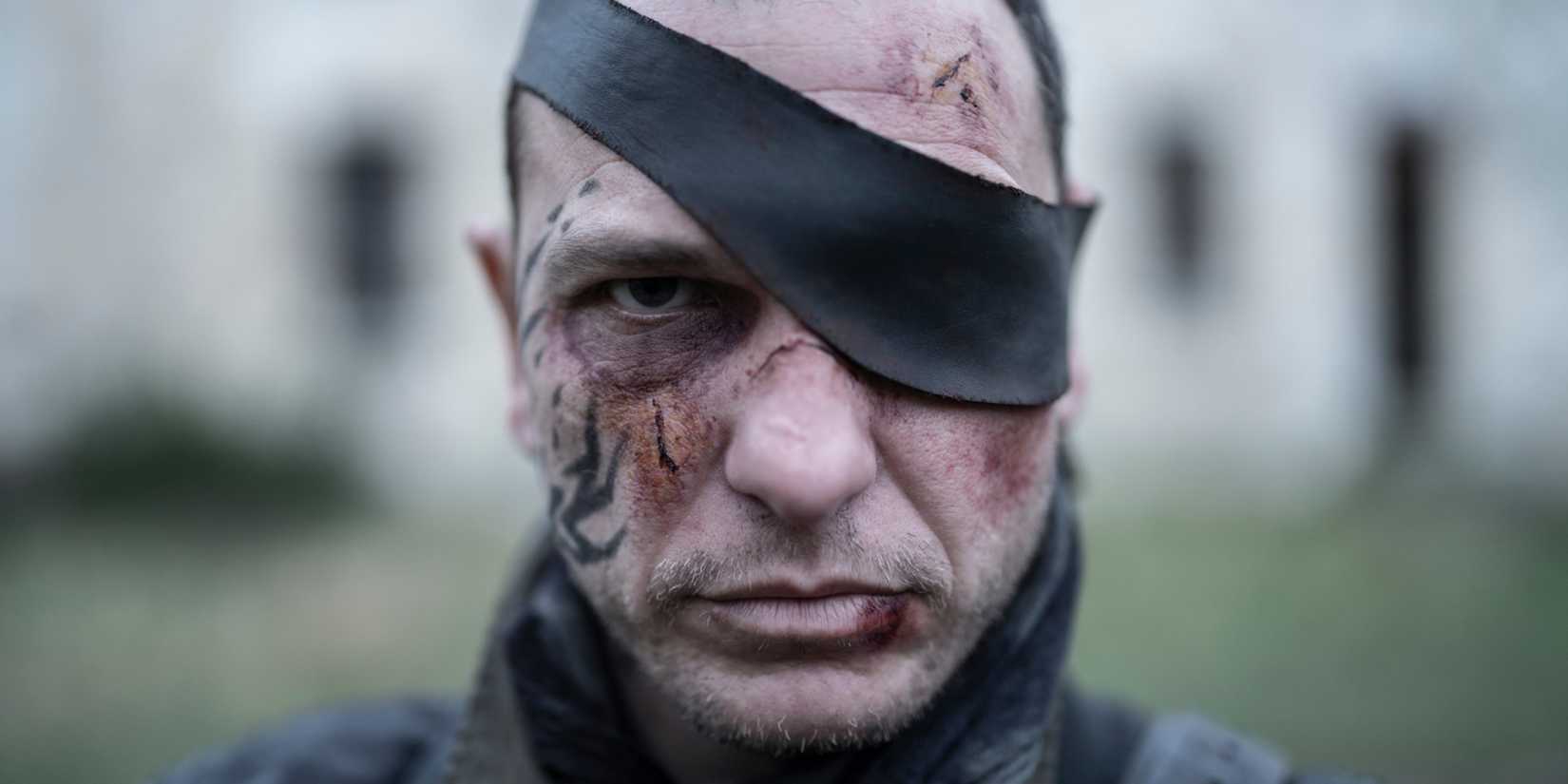 Codron bloodied and wearing an eyepatch in The Walking Dead Daryl Dixon season 2