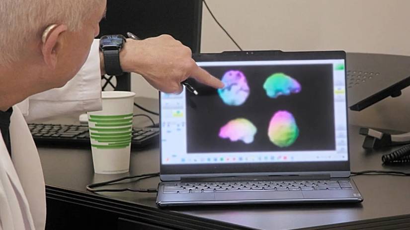 Dr. Amen pointing at Kim Kardashian's brain scan in The Kardashians