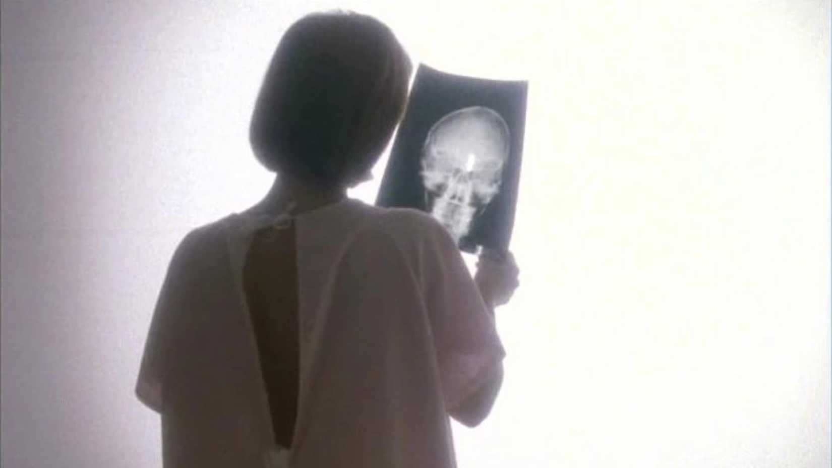 Uma mulher em um roupão de hospital olhando para um exame de cérebro no episódio "Memento Mori" de The X-Files.
