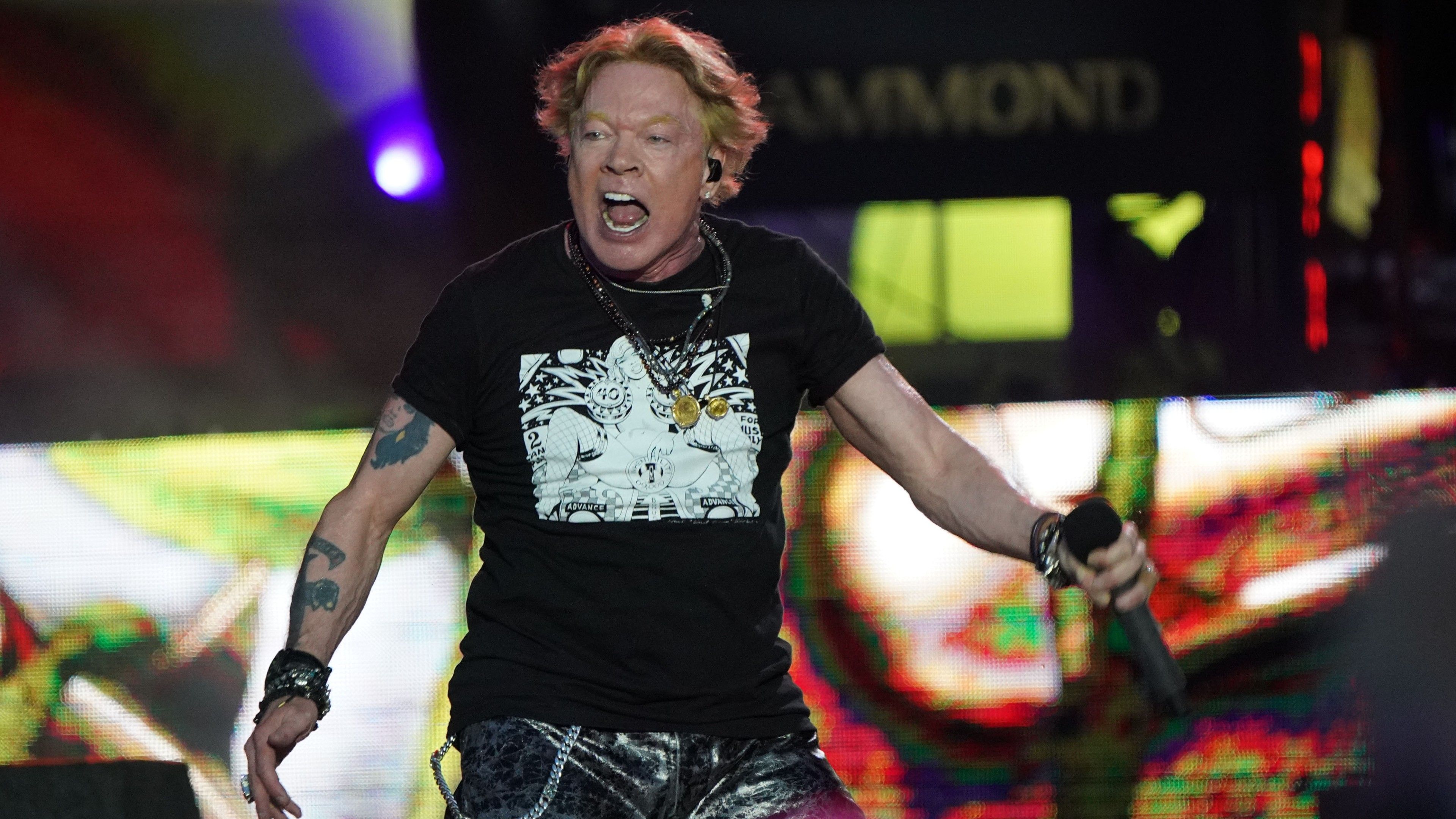 Axl Rose Before And After