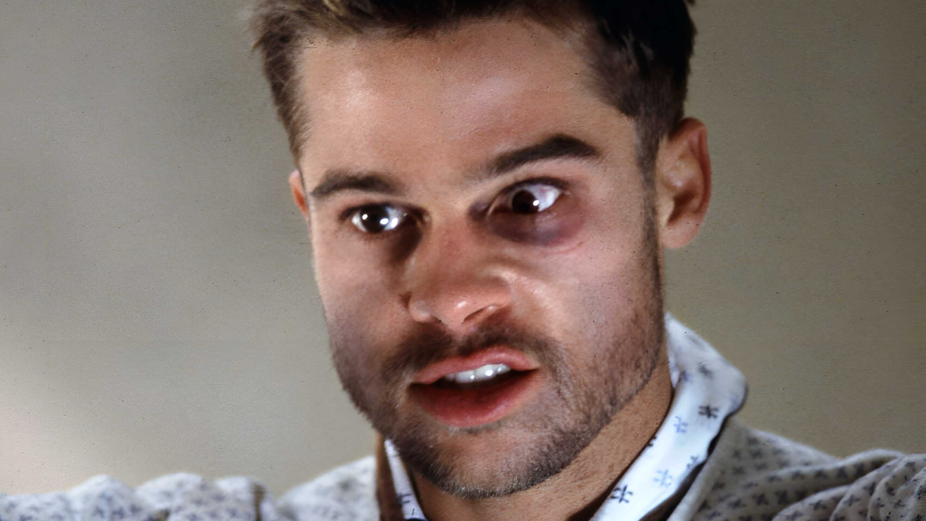 Brad Pitt with a twisted look on his face in 12 Monkeys as Jeffery Goines