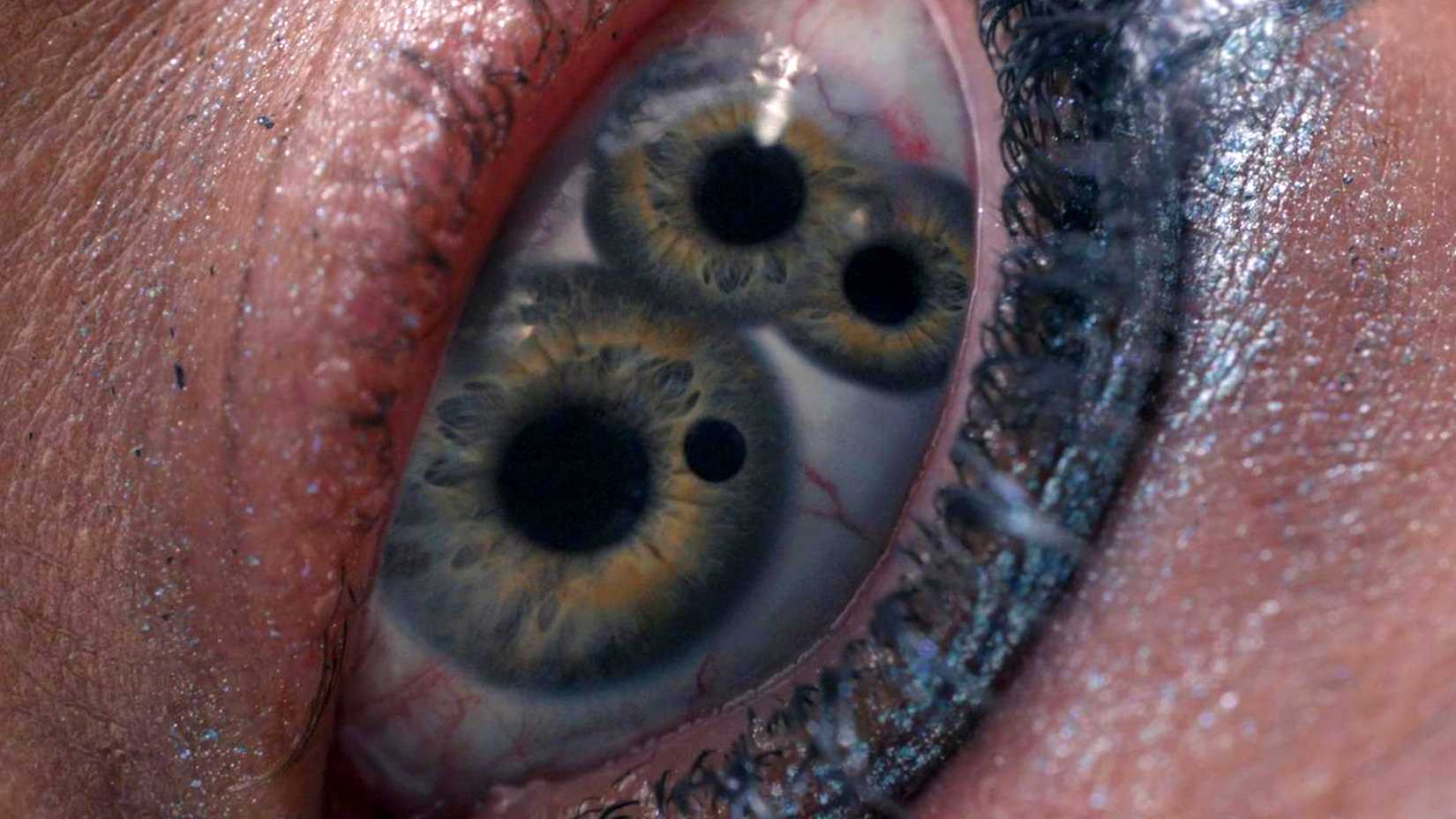 An eye with three pupils in The Substance
