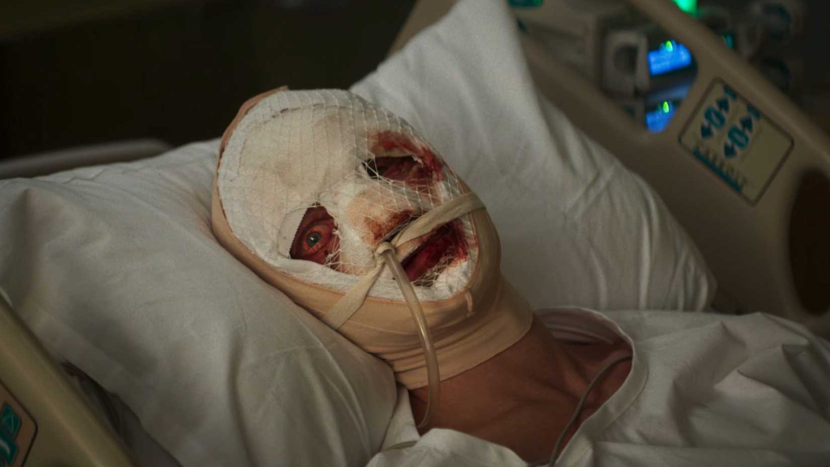 Matt Hagen Bandaged in Bed In Clayface Trailer