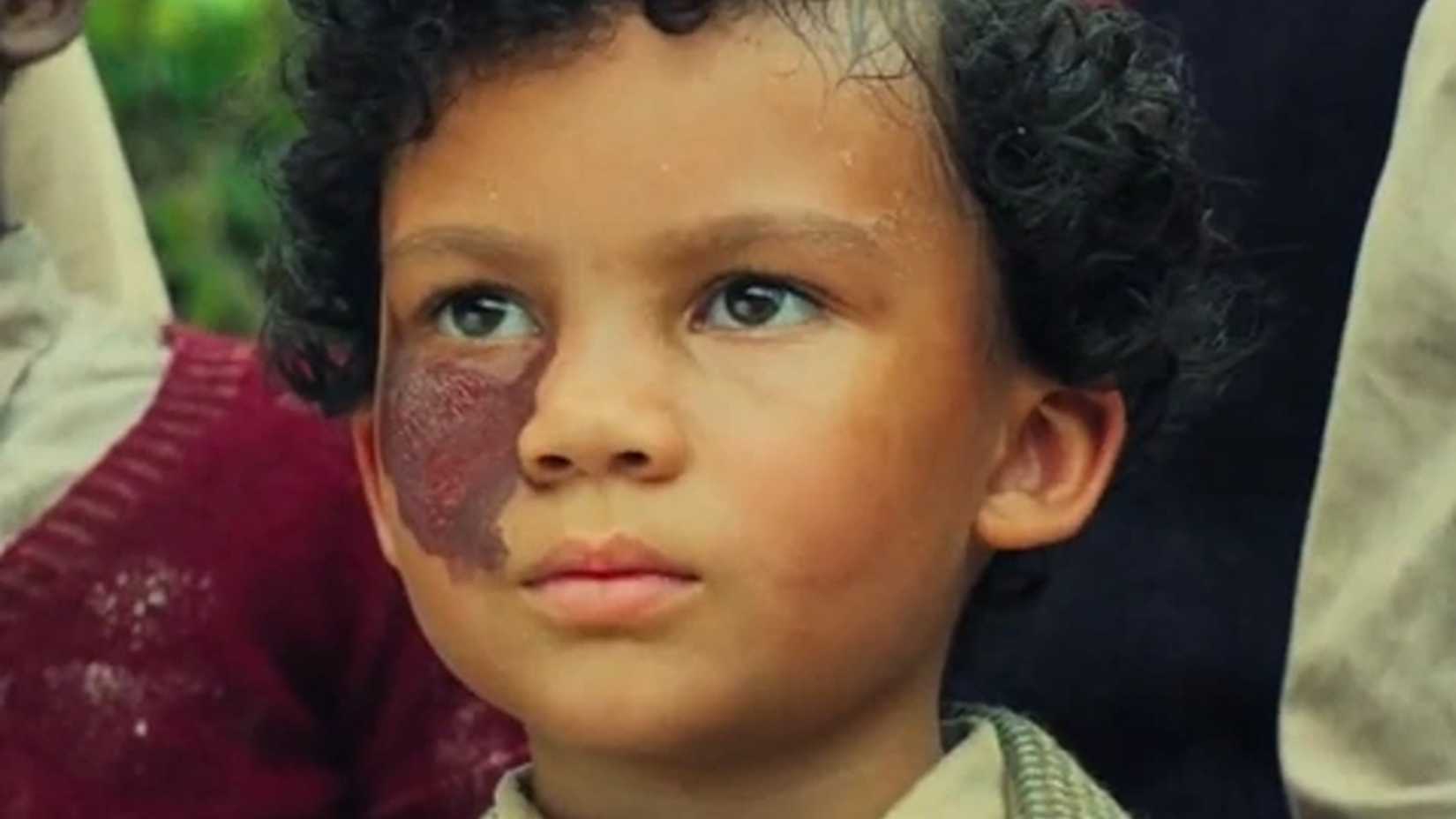 The littlun with a birthmark in Lord of the Flies