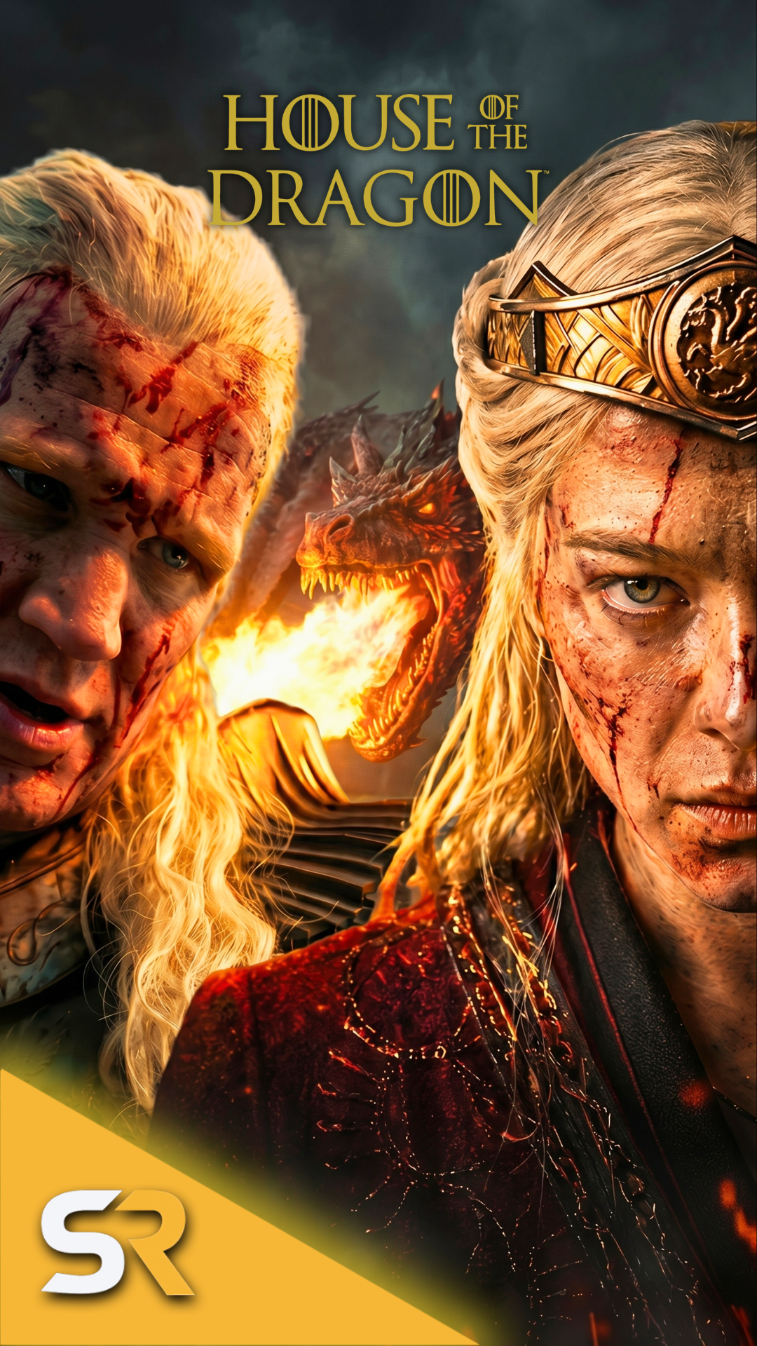 Who is the better player-4-1