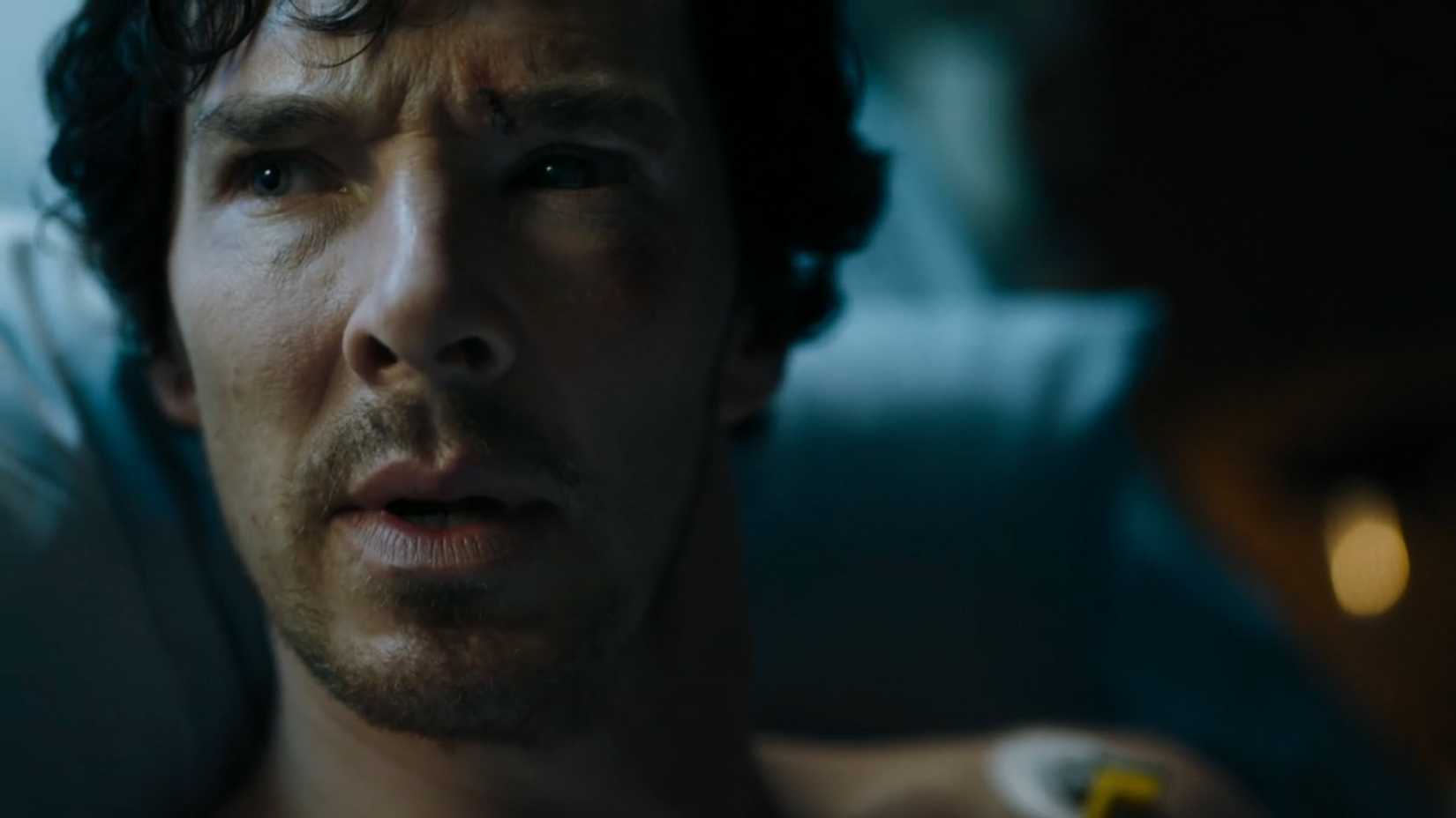 Benedict Cumberbatch as Sherlock Holmes in the hospital at Sherlock tv show