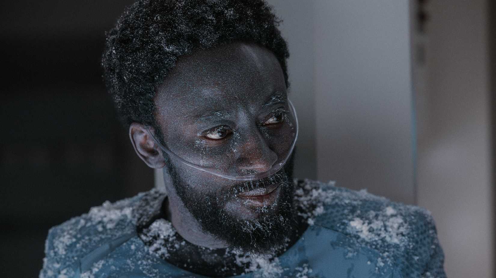Dr. M'Benga Freezing