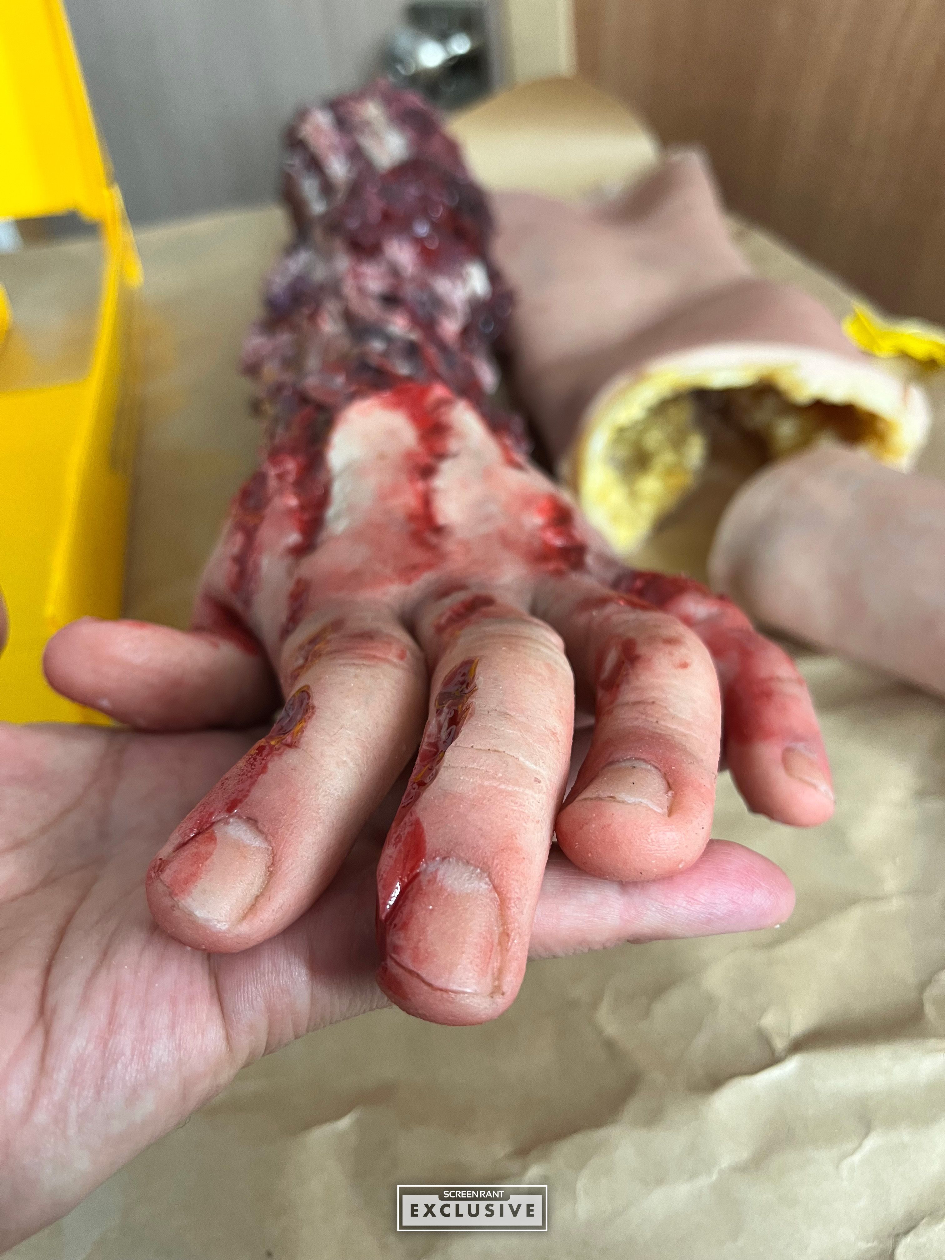 Chicago Med Episode 12 (Last Christmas) Mangled Arm Fingers SCREENRANT EXCLUSIVE-1