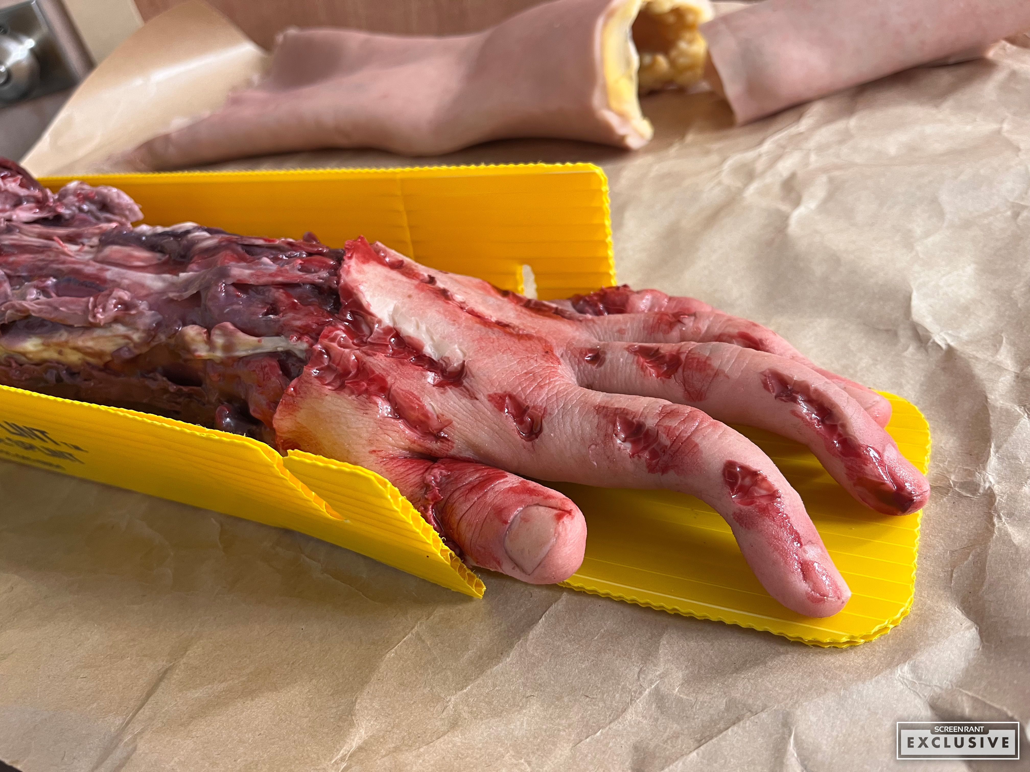 Chicago Med Episode 12 (Last Christmas) Mangled Arm Prop SCREENRANT EXCLUSIVE-1