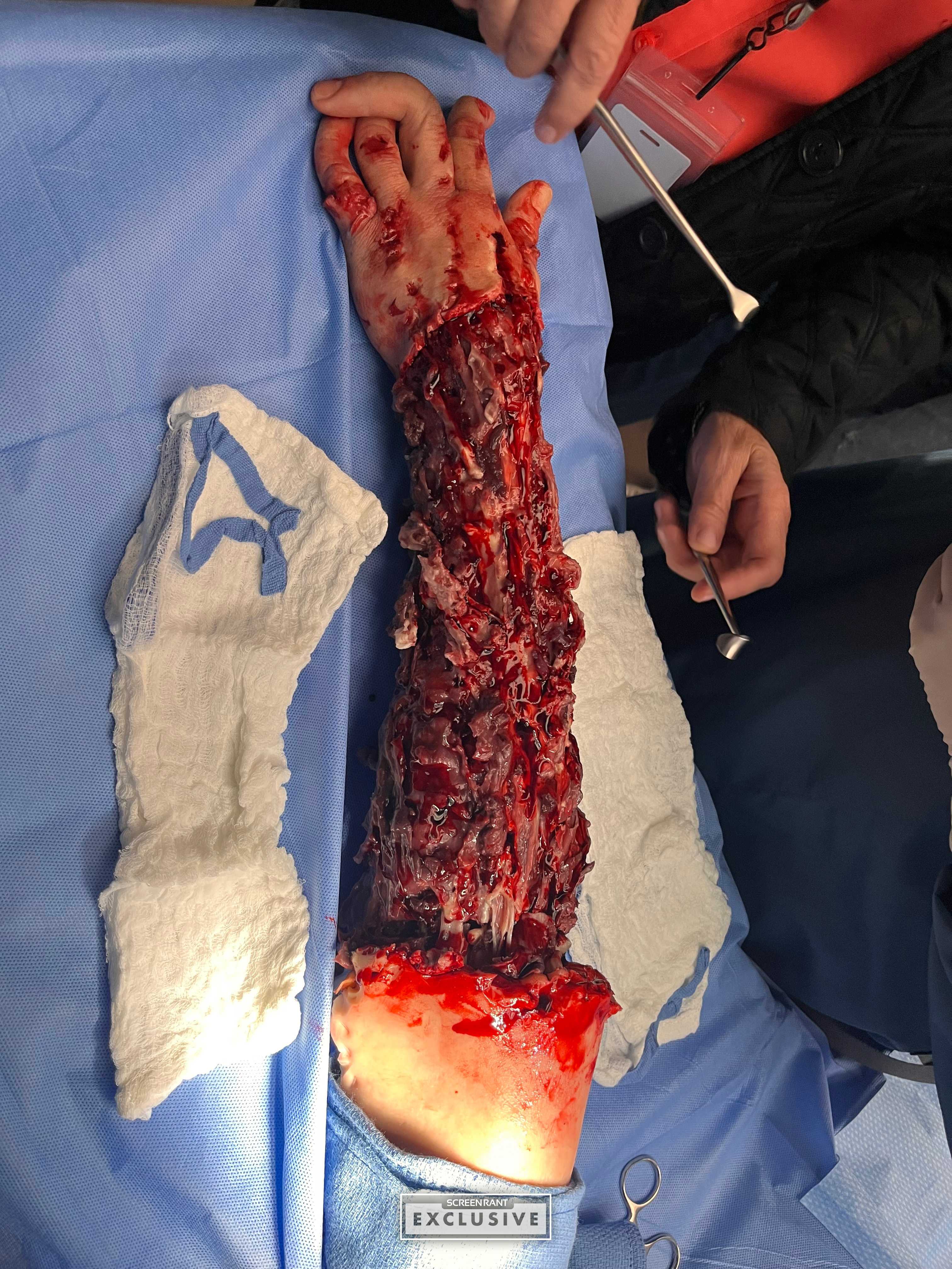 Chicago Med Episode 12 (Last Christmas) Mangled Arm SCREENRANT EXCLUSIVE-1