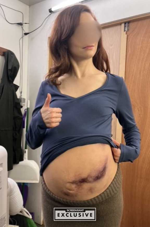 Chicago Med Episode 4 (Tomorrow Tomorrow and Tomorrow) Pregnant Belly SCREENRANT EXCLUSIVE-1
