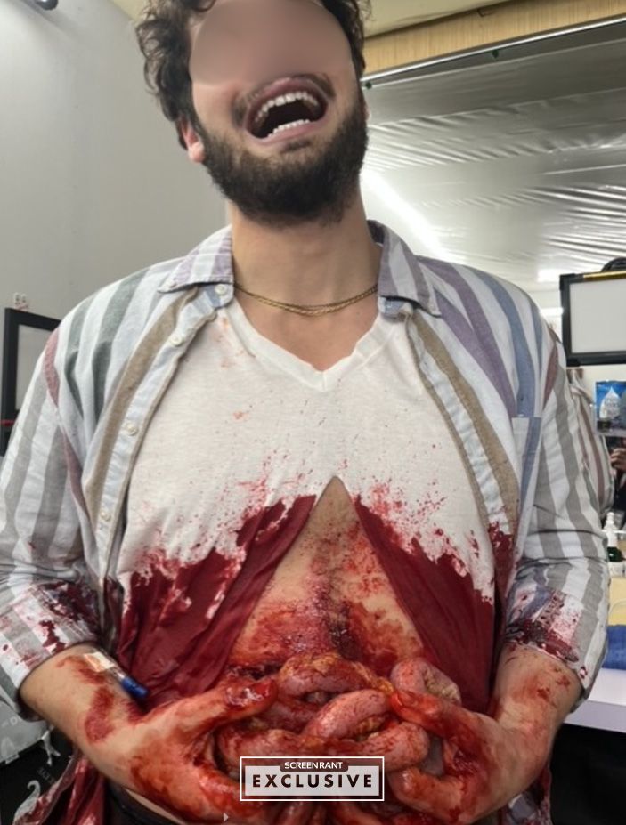 Chicago Med Intestines Prop SCREENRANT EXCLUSIVE
