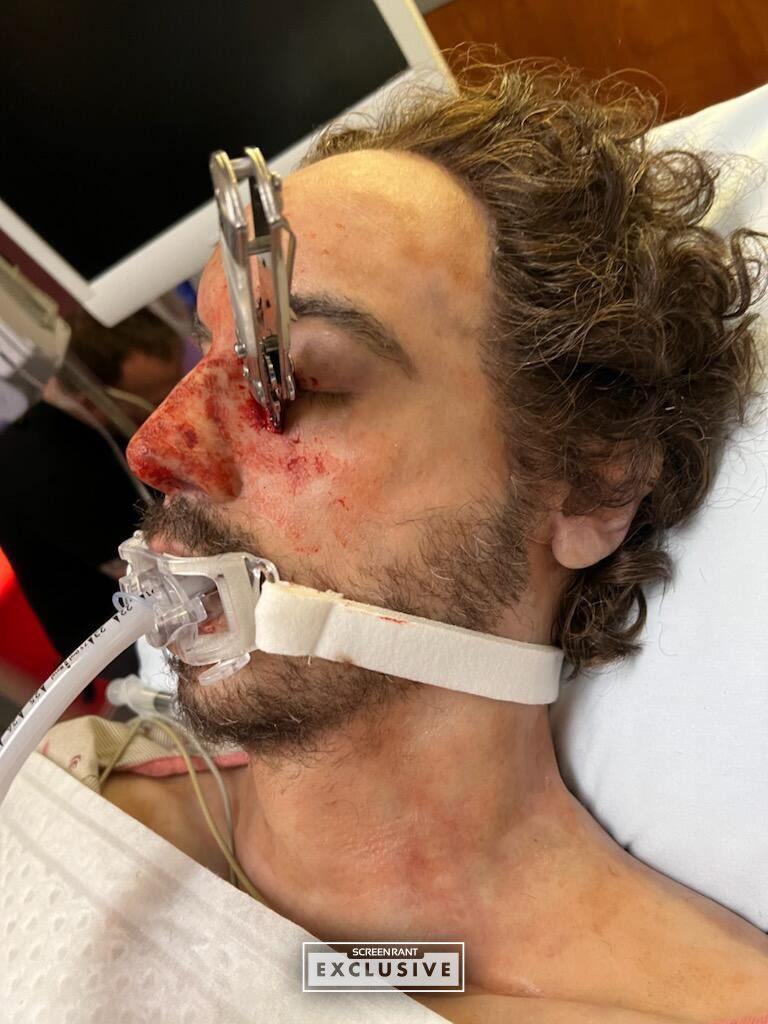 Chicago Med Knife in Face Prop SCREENRANT EXCLUSIVE
