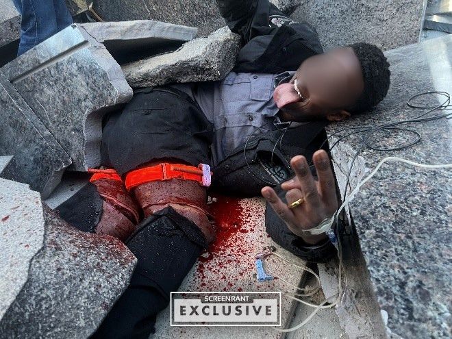 Chicago Med Severed Legs Prop SCREENRANT EXCLUSIVE