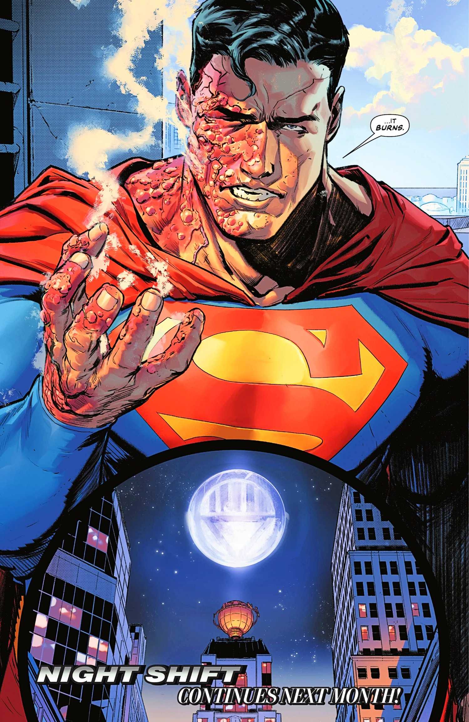 Superman #43, Superman's skin being melted off by sunlight